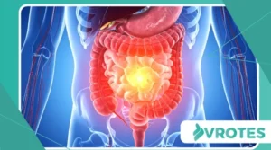 The Role of Gut Health in Reducing Menopause Digestive Issues
