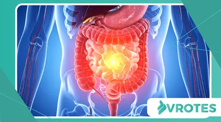 Link Between Gut Inflammation and Anxiety