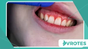 The Surprising Link Between Menopause and Gum Health