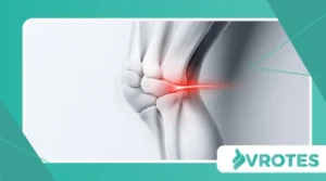 Understanding “Menopausal Joint Pain” Beyond Arthritis