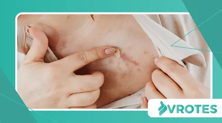 Menopause and Scar Appearance Changes